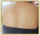 ブライダルエステのお供に…。前撮りまたは披露宴でいつも以上に輝くお肌になる為にキラキラのボディアートをしてみませんか？